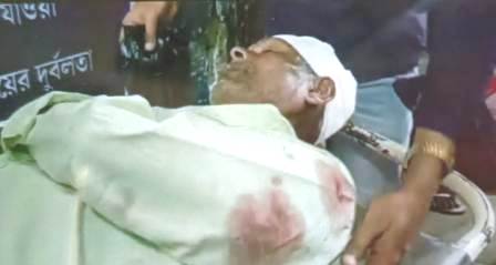 ভোট প্রচারেই তৃণমূলের হাতে আক্রান্ত সিপিএম কর্মী