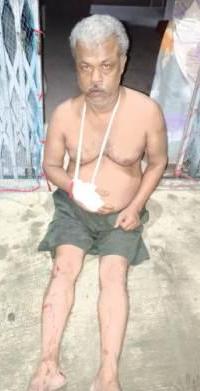 গোবরডাঙায় পারিবারিক বিবাদে আহত ২