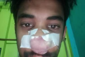 সাংবাদিককে শারীরিক নিগ্রহের মূল অভিযুক্ত গ্রেফতার