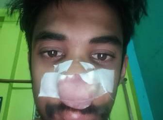 সাংবাদিককে শারীরিক নিগ্রহের মূল অভিযুক্ত গ্রেফতার